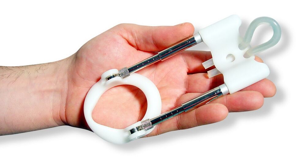 Az extender egy olyan eszköz, amely a pénisz szöveteinek nyújtásán alapul